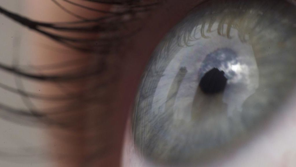 洛伊醫學研究機構的科學家已經確定了導致眼睛衰弱的一個原因。圖像：聯合通訊社提供
